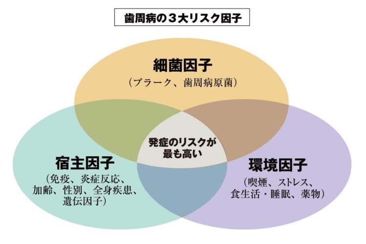 歯周病は、環境や身体の状態が作用して発症・進行する