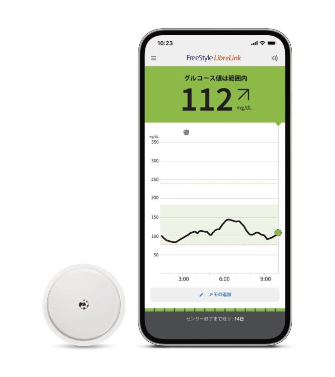 持続グルコース測定器「FreeStyleリブレ 2」（画像提供：アボットジャパン）