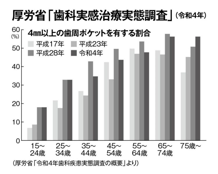 歯周ポケットの深さが4mm以上になると歯周病