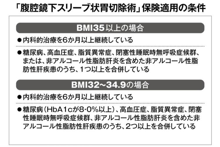 2014年に保険適用となった腹腔鏡下スリーブ状胃切除術