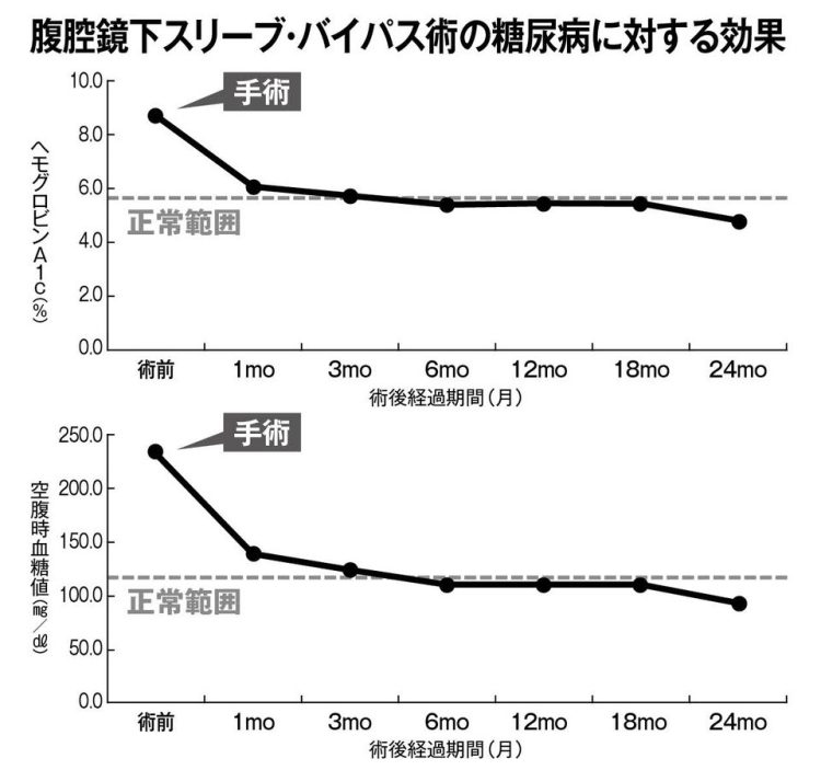 糖尿病患者に対する腹腔鏡下スリーブ・バイパス術後のヘモグロビンA1c、空腹時血糖値の推移（データ／四谷メディカルキューブ）