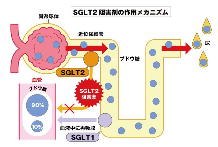 SGLT2阻害薬は2014年に保険承認された