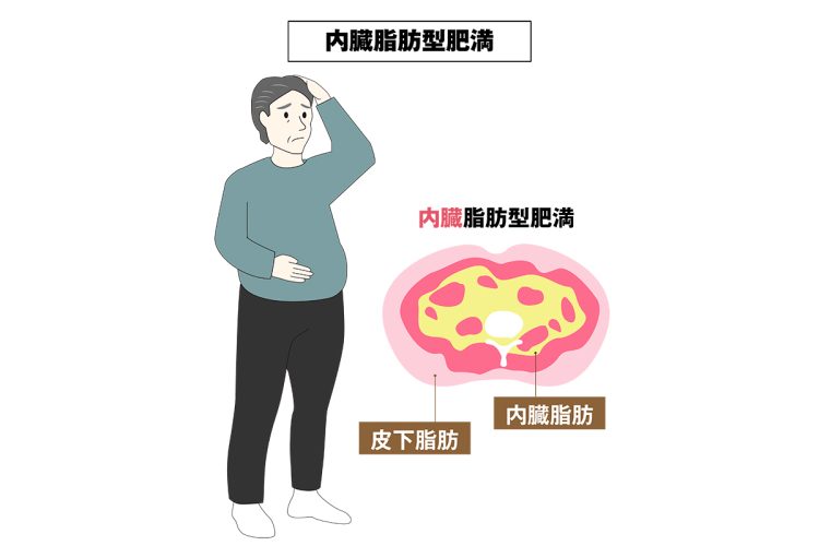 メタボリックシンドロームの肥満は、皮下脂肪よりも内臓付近や内側に脂肪が蓄積している